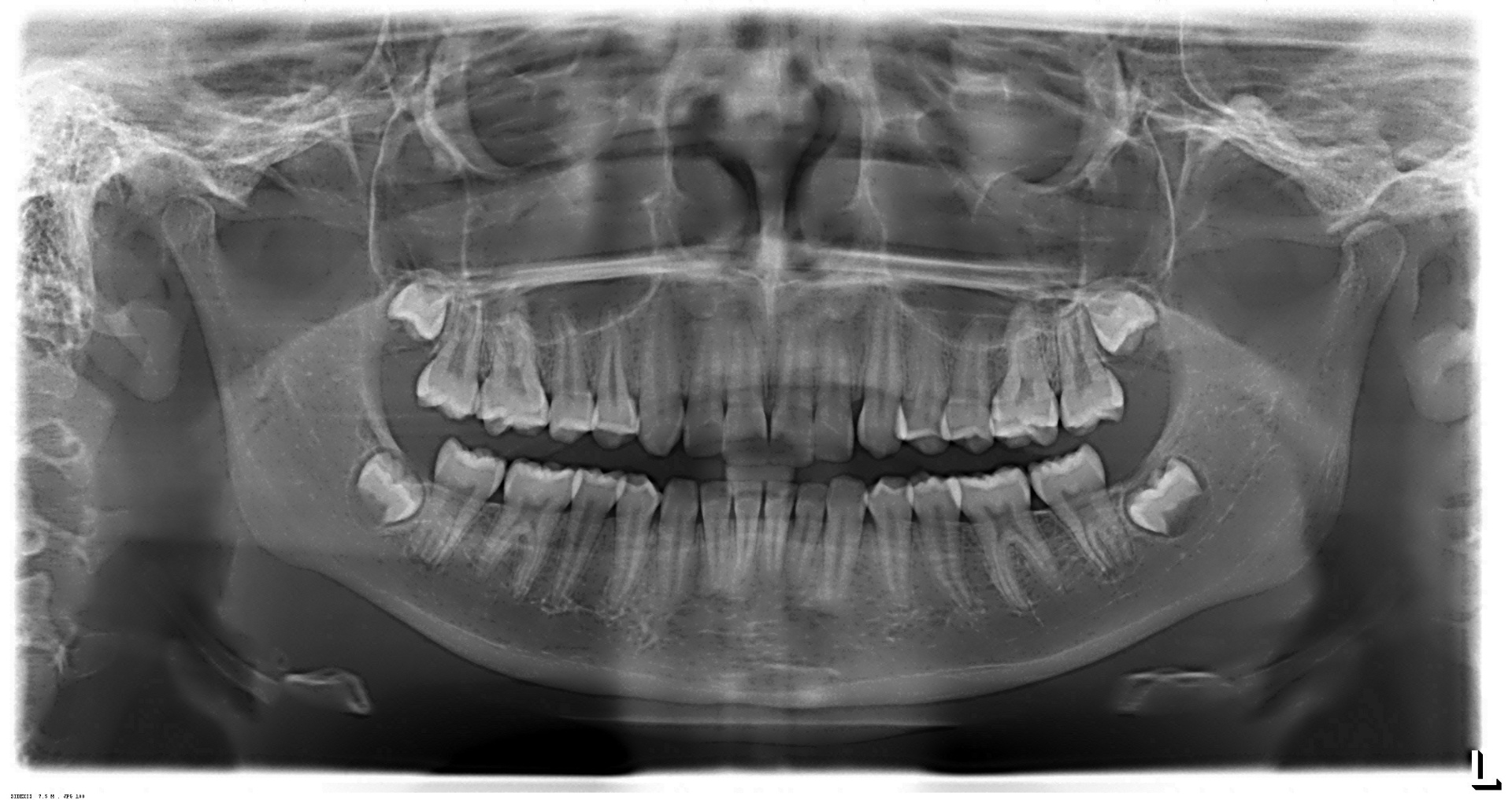 Exame de imagem odontológica 2