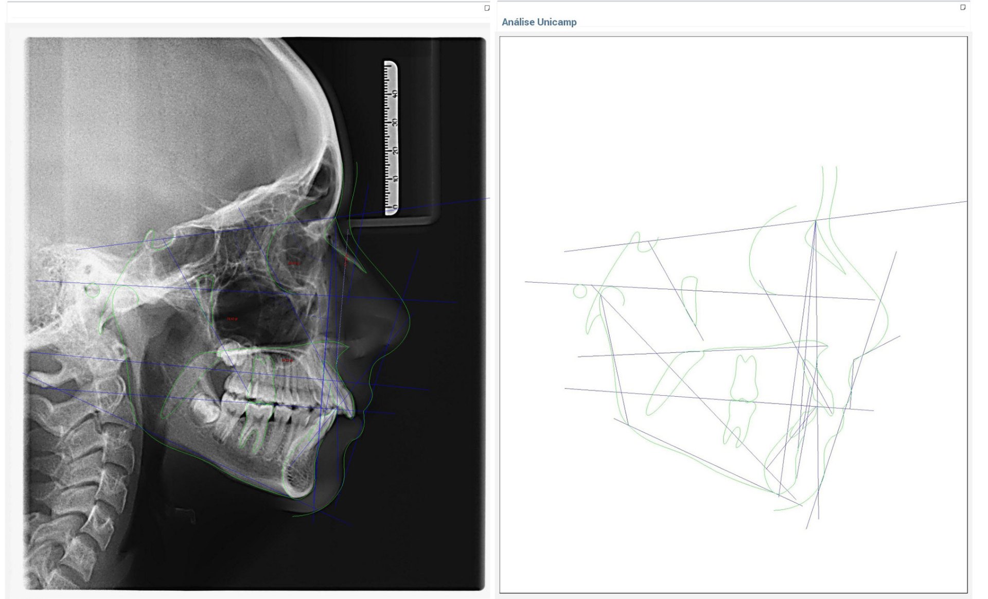 Exame de imagem odontológica 3